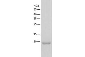Western Blotting (WB) image for Bromodomain Containing 9 (BRD9) (AA 135-242) protein (His tag) (ABIN7288848) (BRD9 Protein (AA 135-242) (His tag))