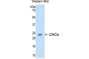 Western blot analysis of the recombinant protein. (Peroxidasin antibody  (AA 1285-1475))
