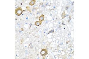 Immunohistochemistry of paraffin-embedded rat brain using MGP antibody (ABIN5975376) at dilution of 1/100 (40x lens). (MGP antibody)