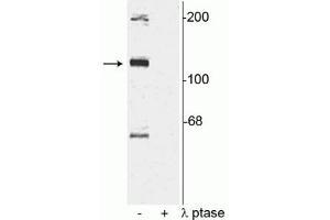Western blot of rat cortical lysate showing specific immunolabeling of the ~120 kDa TAO2 phosphorylated at Ser181 in the first lane (-). (TAO Kinase 2 antibody  (pSer181))
