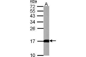WB Image LC3B antibody detects LC3B protein by western blot analysis. (LC3B antibody)