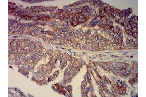 Immunohistochemistry (IHC) image for anti-Basal Cell Adhesion Molecule (Lutheran Blood Group) (BCAM) (AA 32-197) antibody (ABIN7193338)