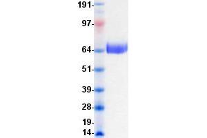 Western Blotting (WB) image for EPH Receptor A3 (EPHA3) protein (DYKDDDDK-His Tag) (ABIN2720235)