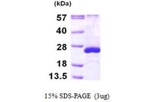 SDS-PAGE (SDS) image for ADP-Ribosylation Factor-Like 5A (ARL5A) (AA 1-179) protein (His tag) (ABIN667845) (ARL5A Protein (AA 1-179) (His tag))