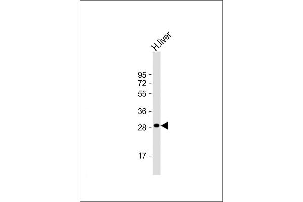 QDPR antibody  (C-Term)