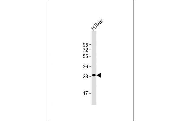 QDPR Antikörper  (C-Term)