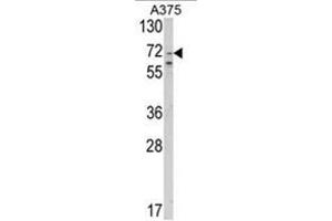 Western blot analysis of SLC23A2 Antibody (N-term) in A375 cell line lysates (35ug/lane).