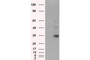 HEK293T cells were transfected with the pCMV6-ENTRY control (Left lane) or pCMV6-ENTRY ERCC1 (Right lane) cDNA for 48 hrs and lysed. (ERCC1 antibody)