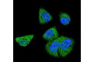 Confocal immunofluorescent analysis of C6 antibody with MDA-MB231 cells followed by Alexa Fluor 488-conjugated goat anti-rabbit lgG (green). (C6 antibody  (AA 30-58))