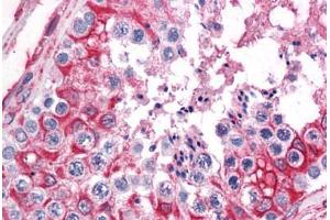 Immunohistochemistry (Formalin-fixed Paraffin-embedded Sections) (IHC (fp)) image for anti-serine Hydroxymethyltransferase 1 (Soluble) (SHMT1) (AA 374-483) antibody (ABIN574342)