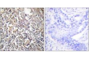 Immunohistochemistry analysis of paraffin-embedded human thyroid gland tissue, using Fibronectin 1 Antibody. (Fibronectin 1 antibody  (AA 2337-2386))