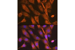 Immunofluorescence analysis of NIH-3T3 cells using PEN2/PSENEN Rabbit mAb (ABIN7269513) at dilution of 1:100 (40x lens). (PEN2 antibody)