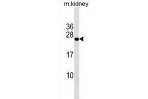 Western Blotting (WB) image for anti-GrpE-Like 2, Mitochondrial (GRPEL2) antibody (ABIN3000757) (GRPEL2 antibody)