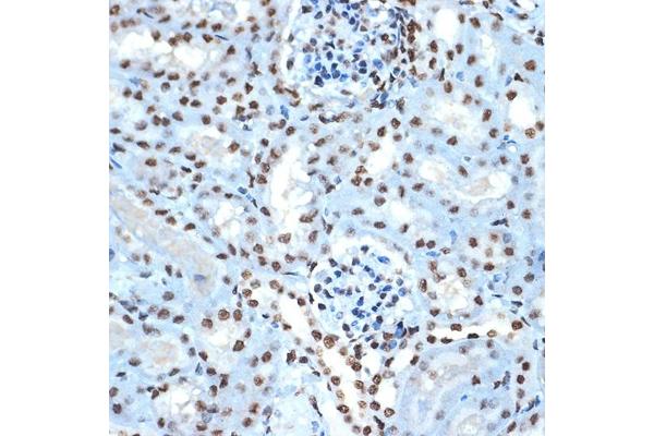 HIST1H2BK antibody
