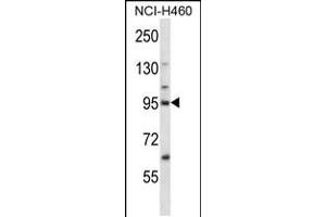 Western blot analysis in NCI-H460 cell line lysates (35ug/lane). (KIF2C antibody  (N-Term))