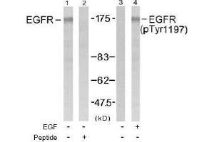Image no. 1 for anti-Epidermal Growth Factor Receptor (EGFR) (pTyr1197) antibody (ABIN196974)