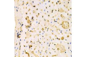 Immunohistochemistry of paraffin-embedded rat heart using KCNH2 antibody at dilution of 1:200 (400x lens). (KCNH2 antibody)