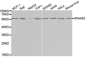 Western blot analysis of extracts of various cell lines, using IFNAR2 antibody (ABIN5970890) at 1/1000 dilution. (IFNAR2 antibody)