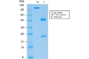 SDS-PAGE Analysis Purified p21 Mouse Recombinant Monoclonal Antibody (rCIP1/823). (Recombinant p21 antibody)