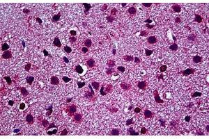 Immunohistochemistry (Formalin-fixed Paraffin-embedded Sections) (IHC (fp)) image for anti-Toll-Like Receptor 9 (TLR9) (AA 204-224), (N-Term) antibody (ABIN625866)