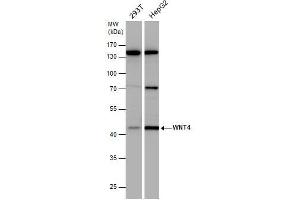 WB Image WNT4 antibody detects WNT4 protein by western blot analysis.