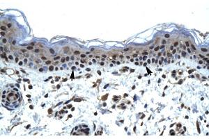 Human Skin (IKZF5 antibody  (N-Term))