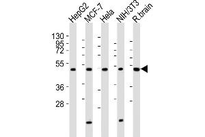 All lanes : Anti-P2R2A Antibody (N-term) at 1:2000 dilution Lane 1: HepG2 whole cell lysates Lane 2: MCF-7 whole cell lysates Lane 3: Hela whole cell lysates Lane 4: NIH/3T3 whole cell lysates Lane 5: rat brain lysates Lysates/proteins at 20 μg per lane. (PPP2R2A antibody  (N-Term))