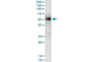 Immunoprecipitation of GAK transfected lysate using anti-GAK monoclonal antibody and Protein A Magnetic Bead , and immunoblotted with GAK monoclonal antibody. (GAK antibody  (AA 151-250))