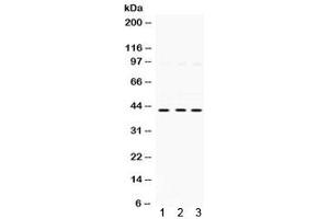 Western blot testing of 1) rat kidney, 2) human HeLa, and 3) human A549 lysate with SAPK4 antibody. (MAPK13 antibody)