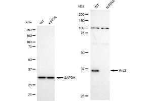 Western blotting analysis using Arg2 antibody (ABIN7797644). (Recombinant ARG2 antibody)