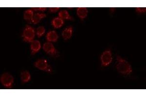 ABIN6275953 staining Hela by IF/ICC. (G Protein-Coupled Receptor 110 antibody  (C-Term))