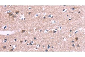 Immunohistochemistry of paraffin-embedded Human brain tissue using DUSP13 Polyclonal Antibody at dilution 1:60 (DUSP13 antibody)
