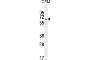 Western Blotting (WB) image for anti-UNC Homeobox (UNCX) antibody (ABIN2996063) (UNCX antibody)
