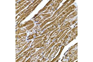Immunohistochemistry of paraffin-embedded mouse heart using BNP Rabbit pAb (ABIN3023135, ABIN3023136, ABIN3023137, ABIN1513273 and ABIN6219406) at dilution of 1:200 (40x lens). (NPPB antibody  (AA 1-134))