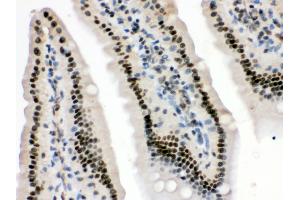 Anti- HMG4 Picoband antibody, IHC(P) IHC(P): Mouse Intestine Tissue (HMGB3 antibody  (N-Term))