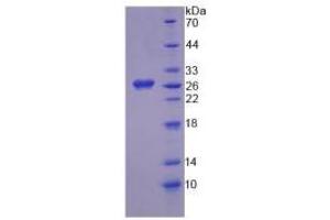 SDS-PAGE analysis of Human HGD Protein. (HGD Protein)