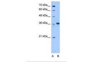 Image no. 1 for anti-Aminoadipate-Semialdehyde Dehydrogenase-phosphopantetheinyl Transferase (AASDHPPT) (C-Term) antibody (ABIN6738500) (AASDHPPT antibody  (C-Term))