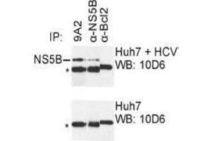 Western Blotting (WB) image for anti-Hepatitis C Virus NS5 (HCV NS5) (AA 111-130) antibody (ABIN781784) (HCV NS5 antibody  (AA 111-130))