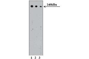 Western blot analysis of CRIK on Human Jurkat cell lysate (ATCC TIB-152). (CIT antibody  (AA 1420-1612))