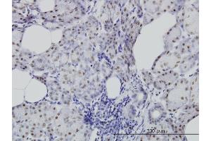 Immunoperoxidase of monoclonal antibody to CDC25C on formalin-fixed paraffin-embedded human salivary gland. (CDC25C antibody  (AA 21-130))