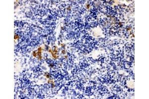 IHC-P: Leupaxin antibody testing of rat spleen tissue (Leupaxin antibody  (N-Term))