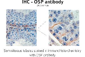 Image no. 1 for anti-Claudin 11 (CLDN11) (C-Term) antibody (ABIN346949) (Claudin 11 antibody  (C-Term))