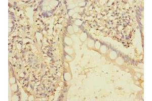 Immunohistochemistry of paraffin-embedded human small intestine tissue using ABIN7166436 at dilution of 1:100 (EEF2KMT (AA 1-330) antibody)