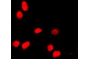 Immunofluorescent analysis of Histone H3 (pT11) staining in HepG2 cells. (Histone 3 antibody  (pSer11))