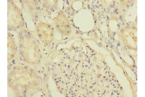 Immunohistochemistry of paraffin-embedded human kidney tissue using ABIN7170191 at dilution of 1:100 (SLC25A36 antibody  (AA 58-110))