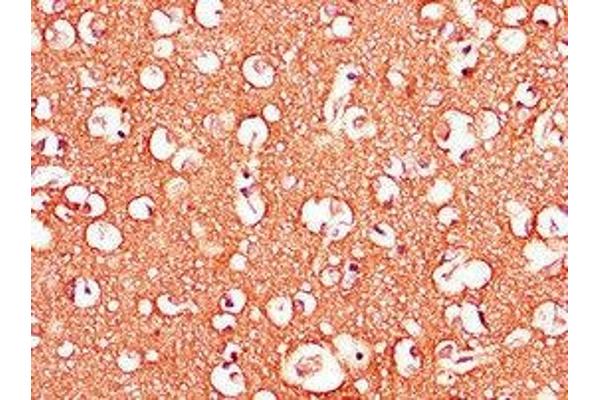 Adenosine A2b Receptor antibody  (AA 292-332)