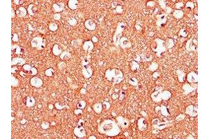 Immunohistochemistry of paraffin-embedded human brain tissue using ABIN7143307 at dilution of 1:100 (Adenosine A2b Receptor antibody  (AA 292-332))
