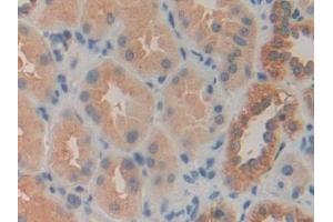 Immunohistochemistry (IHC) image for anti-Calcyclin Binding Protein (CACYBP) (AA 2-228) antibody (ABIN7434842)