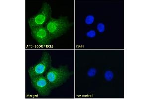ABIN185043 Immunofluorescence analysis of paraformaldehyde fixed A431 cells, permeabilized with 0. (BCOR antibody  (N-Term))