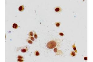 Immunocytochemistry analysis of MCF-7 cells using ABIN7139591 at dilution of 1:100 (HIST1H1E antibody  (meLys147))